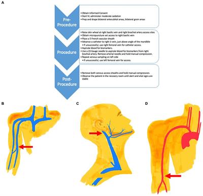 Cerebral venous biomarkers and veno-arterial gradients: untapped resources in Alzheimer’s disease